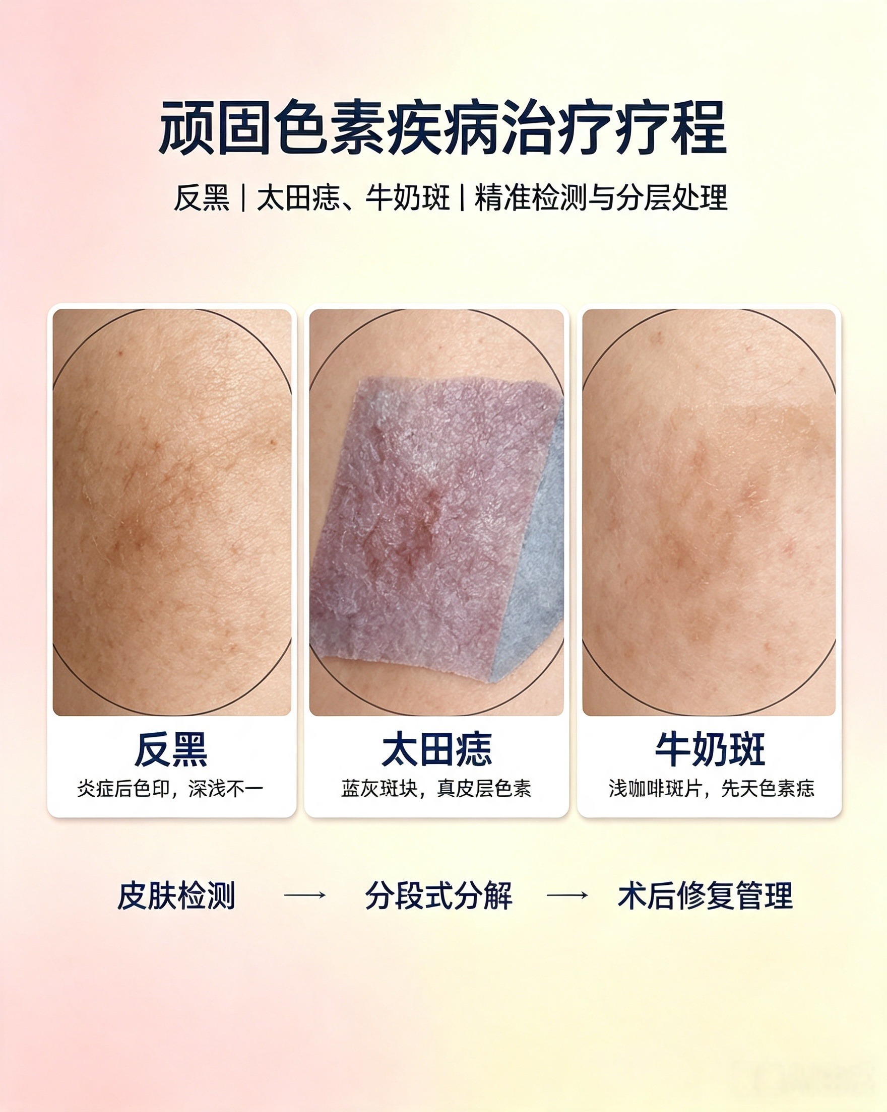 頑固性色素疾病治療